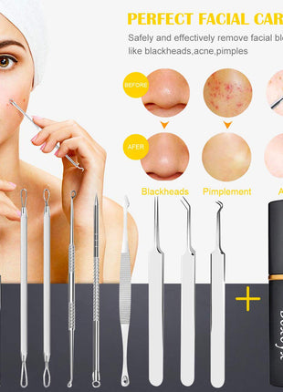 Pimple Popper Tool Kit - Boxoyx 10 Pcs Blackhead Remover Comedone Extractor Kit with Metal Case for Quick and Easy Removal of Pimples, Blackheads, Zit Removing, Forehead,Facial and Nose(Silver)